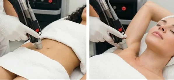 KOMPLEKT: kaenlaalused ja täielik bikiinipiirkond ( Tavahind 174€)